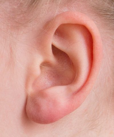 oreille